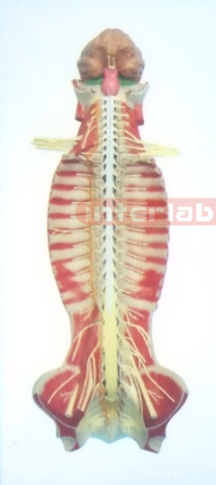 SMALL HANGING HUMAN SPINAL CORD MODEL IN SPINAL CANAL